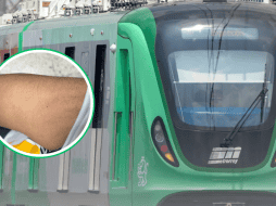 La imagen que muestra una pequeña marca roja en el brazo del joven, presuntamente provocada por el pinchazo. FACEBOOK / Valeria Macías / https://www.metrorrey.mx/