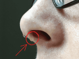 Una nariz que no deja de gotear puede parecer solo una molestia, pero también puede ser la forma en que tu cuerpo te advierte de un problema subyacente. CANVA