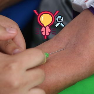 Así se trata el cáncer de próstata