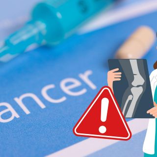 3 profesiones que "aumentan" el riesgo de cáncer según la Cancer Research UK