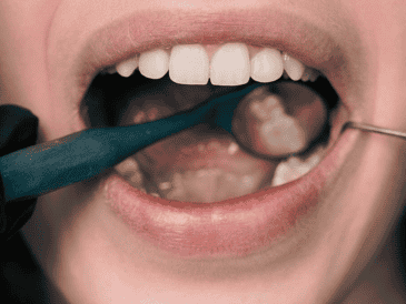 Ante problemas de salud bucal, lo mejor es asistir con un dentista. ESPECIAL / CANVA