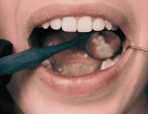 Ante problemas de salud bucal, lo mejor es asistir con un dentista. ESPECIAL / CANVA