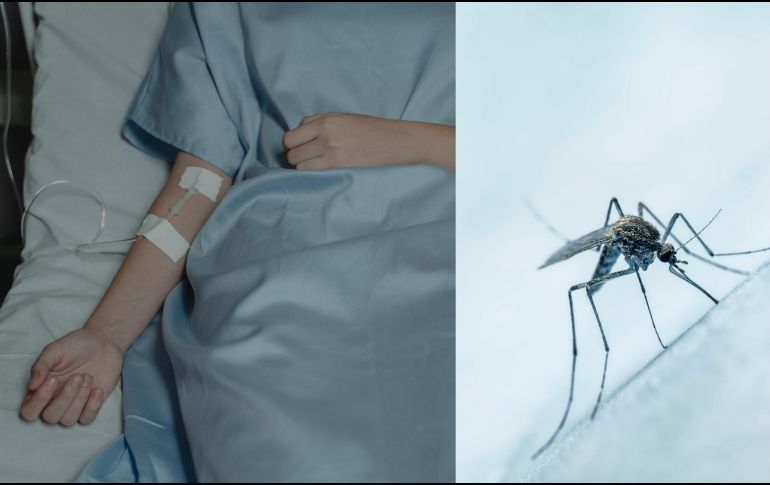 Los síntomas del dengue, conocido comúnmente como 