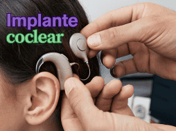 La colocación de este dispositivo es un procedimiento seguro, con una tasa baja de complicaciones intra y postoperatorias. ESPECIAL / CANVA