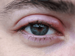 ¿Por qué salen perrillas en los ojos? UNSPLASH / E. MARSAN