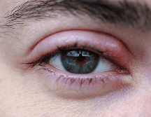 ¿Por qué salen perrillas en los ojos? UNSPLASH / E. MARSAN