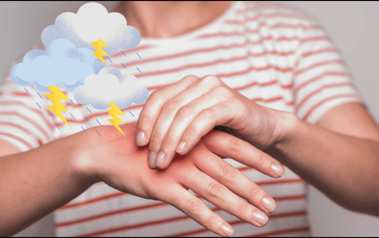 Las personas con dolor articular deben moverse, no quedarse quietas. La inactividad puede empeorar los síntomas. FREEPIK / CANVA