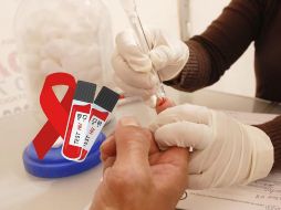 Ahora el VIH se está generalizado, por lo que lo casos en población heterosexual son cada vez más frecuentes. SUN / ARCHIVO