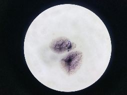 El hallazgo también replantea la necesidad de conocer con más detalle la población de bacterias que pueden colonizar el útero. UNSPLASH / C. Qi Huang