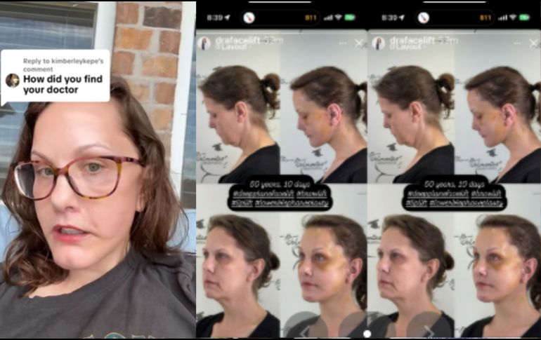 A través de una serie de publicaciones en su cuenta de TikTok, Michelle Wood reveló los procedimientos a los que se sometió con el fin de refrescar su imagen. TIKTOK/michellewood165