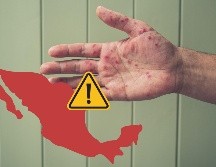 El nuevo brote de sarampión a nivel nacional sigue en aumento. Hasta este martes 30 de septiembre en todo el país se tenían registrados 4 mil 758 casos en total y 21 defunciones de acuerdo con datos de la Secretaría de Salud. ESPECIAL