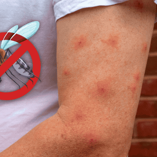 Este color de ropa atrae más a los mosquitos