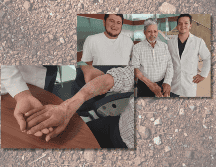 El paciente acudió al servicio de Urgencias del Seguro Social con más de 48 horas de evolución, pero al final el resultado fue positivo. ESPECIAL / IMSS