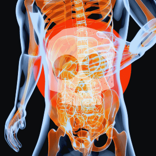 ¿Qué es el cáncer de estómago y por qué es potencialmente mortal?