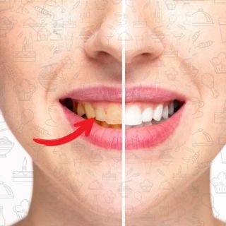 6 alimentos populares que manchan los dientes y no lo sabías