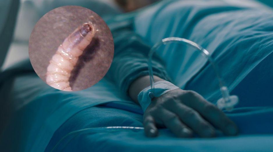 Al menos 5 de los casos perdieron la vida mientras recibían tratamiento, aunque ninguno está atribuido al caso de miasis. CANVA / ESPECIAL