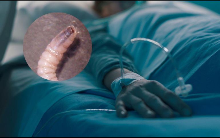 Al menos 5 de los casos perdieron la vida mientras recibían tratamiento, aunque ninguno está atribuido al caso de miasis. CANVA / ESPECIAL