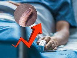 El gusano barrenador es un parásito que se transmite por medio de una mosca. CANVA / ESPECIAL