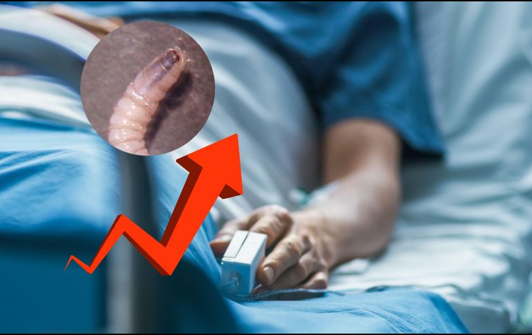 El gusano barrenador es un parásito que se transmite por medio de una mosca. CANVA / ESPECIAL