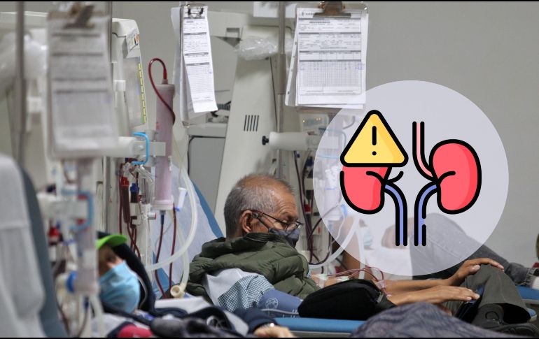 El fármaco aumenta la producción de espermidina, lo que inhibe el daño renal adicional. EL INFORMADOR / ARCHIVO