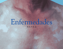 Esta enfermedad presenta alteraciones de coloración como hiperpigmentación o manchas similares al vitíligo. ESPECIAL / CANVA