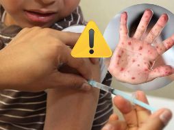 Se trata de un menor de 5 años de edad que hizo escala en el estado de Michoacán, acompañado de su familia. ESPECIAL / IMSS / SUN / ARCHIVO