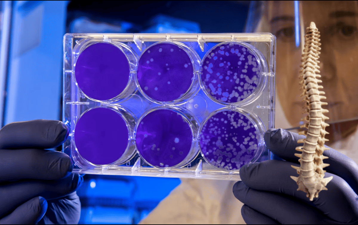 Este tratamiento ayudará a tratar lesiones en la médula espinal. UNSPLASH / CDC