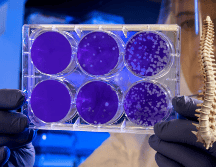 Este tratamiento ayudará a tratar lesiones en la médula espinal. UNSPLASH / CDC