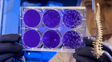 Este tratamiento ayudará a tratar lesiones en la médula espinal. UNSPLASH / CDC