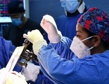 Estas intervenciones consisten en implantar pequeños electrodos en zonas específicas del cerebro que controlan el movimiento. ESPECIAL / SEMAR