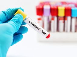 La Organización Mundial de la Salud estima que hasta el 90% de los infartos cerebrales son prevenibles. ESPECIAL / CANVA