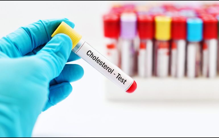 La Organización Mundial de la Salud estima que hasta el 90% de los infartos cerebrales son prevenibles. ESPECIAL / CANVA