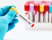 La Organización Mundial de la Salud estima que hasta el 90% de los infartos cerebrales son prevenibles. ESPECIAL / CANVA