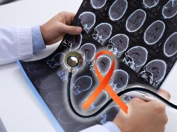 La esclerosis múltiple es más común 3 a 1 en las mujeres que en el hombre, afecta entre los 20 y 40 años, aunque puede presentarse a cualquier edad. ESPECIAL / CANVA