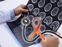 La esclerosis múltiple es más común 3 a 1 en las mujeres que en el hombre, afecta entre los 20 y 40 años, aunque puede presentarse a cualquier edad. ESPECIAL / CANVA