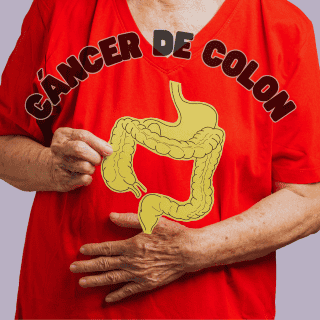 El peligroso avance del cáncer de colon en México