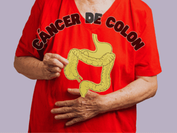 El de colon, es el tercer cáncer más común en la población mexicana y afecta más a hombres que a mujeres. ESPECIAL / CANVA