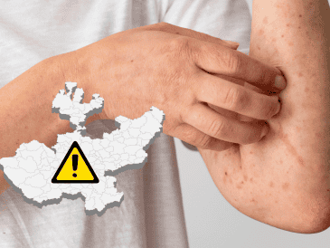 El Gobierno municipal de San Pedro Tlaquepaque aseguró que refuerza los protocolos de vacunación con módulos. CANVA