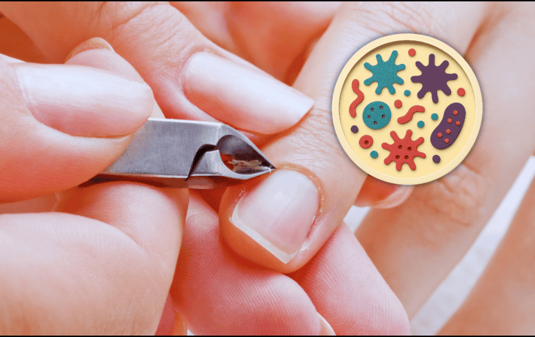 Al eliminar o cortar las cutículas, se elimina esa barrera protectora y la matriz ungueal queda expuesta a infecciones. ESPECIAL / CANVA