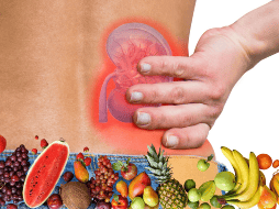 Aunque la carambola puede disfrutarse con moderación por personas sanas, quienes padecen enfermedades renales deben evitarla por completo. CANVA