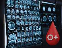 Las pruebas actuales de alzhéimer, como el análisis del líquido cefalorraquídeo o las técnicas de imagen cerebral (como el PET), son invasivas, caras o poco accesibles. ESPECIAL