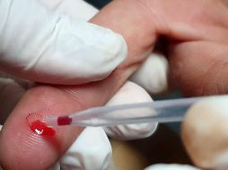 Algunos síntomas del VIH son similares a los de la influenza y pueden aparecer entre dos y cuatro semanas después de la infección. EL INFORMADOR / ARCHIVO