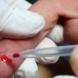 ¿Se eliminó el fondo público para tratar el VIH/Sida? Todo lo que sabemos