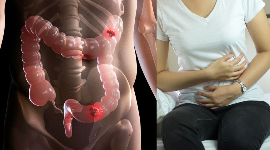 Cuando el cáncer avanza, o incluso en fases tempranas, existen otros indicadores que requieren una evaluación médica inmediata. CANVA