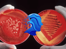 Esta herramienta reduce el sesgo en análisis patológicos de cáncer. UNSPLASH / NCI