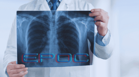 La EPOC se manifiesta principalmente en personas mayores de 40 años y hoy figura entre las principales causas de fallecimiento en México. ESPECIAL / CANVA