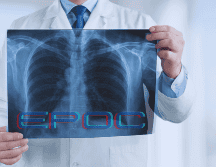 La EPOC se manifiesta principalmente en personas mayores de 40 años y hoy figura entre las principales causas de fallecimiento en México. ESPECIAL / CANVA