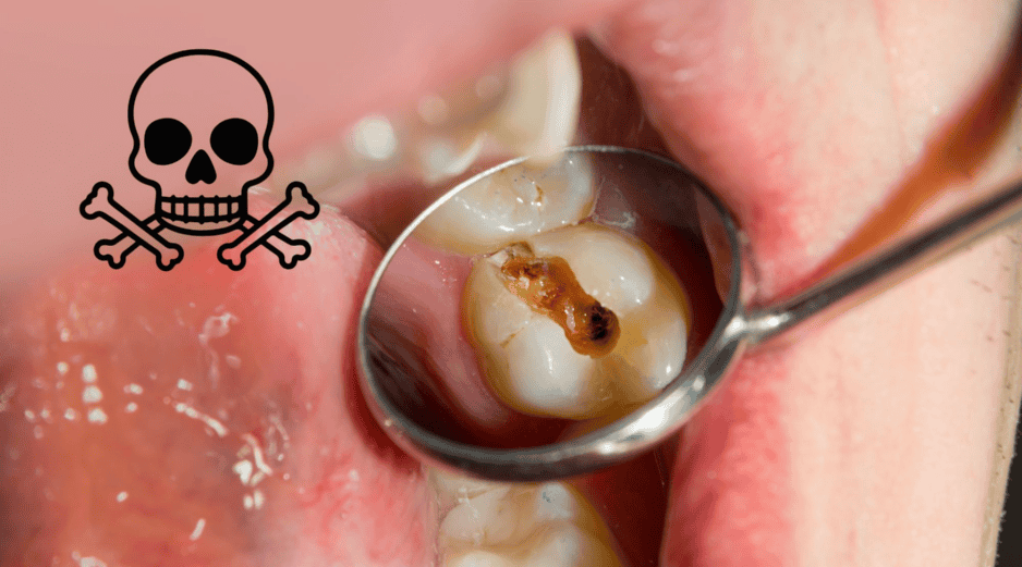 Existen factores que incrementan el riesgo de estas complicaciones, como la falta de atención odontológica, sistemas inmunológicos debilitados, enfermedades crónicas como la diabetes y el uso prolongado de ciertos medicamentos. CANVA