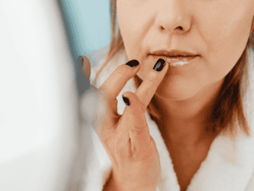 La receta de Profeco ayuda a prevenir grietas y dolor en los labios causados por las bajas temperaturas. CANVA