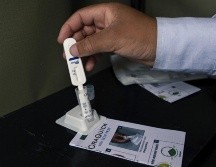 Datos de las autoridades de salud muestran que durante el año 2024 se notificaron 940 nuevos casos de VIH en Costa Rica. ESPECIAL / AFP